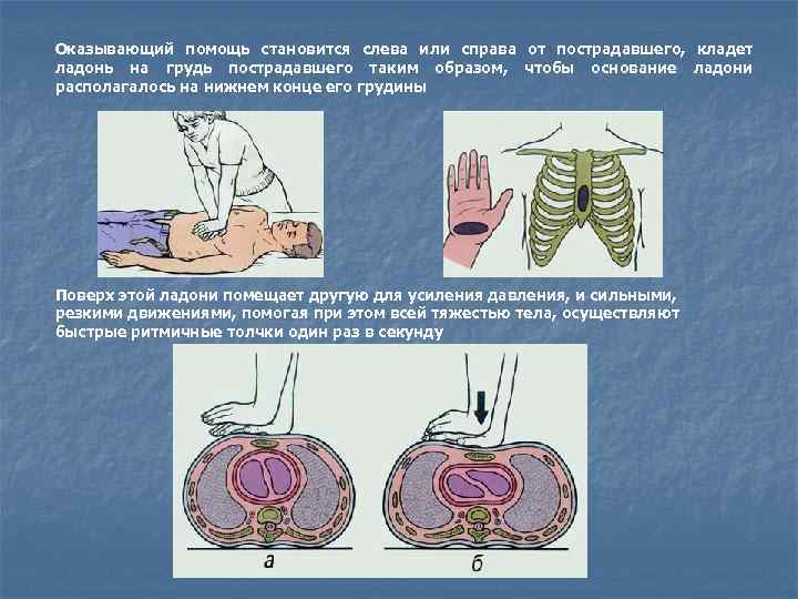 Оказывающий помощь становится слева или справа от пострадавшего, кладет ладонь на грудь пострадавшего таким