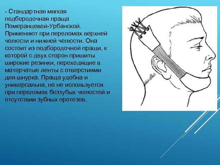  Стандартная мягкая подбородочная праща Померанцевой Урбанской. Применяют при переломах верхней челюсти и нижней