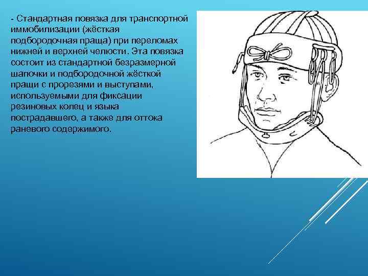  Стандартная повязка для транспортной иммобилизации (жёсткая подбородочная праща) при переломах нижней и верхней