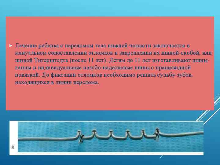  Лечение ребенка с переломом тела нижней челюсти заключается в мануальном сопоставлении отломков и
