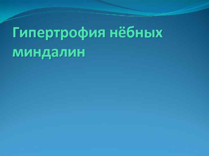 Гипертрофия нёбных миндалин 