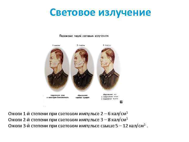 Световое излучение Ожоги 1 -й степени при световом импульсе 2 – 6 кал/см 2