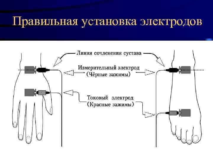 Правильная установка электродов 2/18/2018 31 