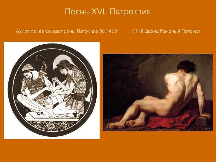 Песнь XVI. Патроклия Ахилл перевязывает раны Патрокла 500 -490 Ж. -Л. Давид Раненый Патрокл