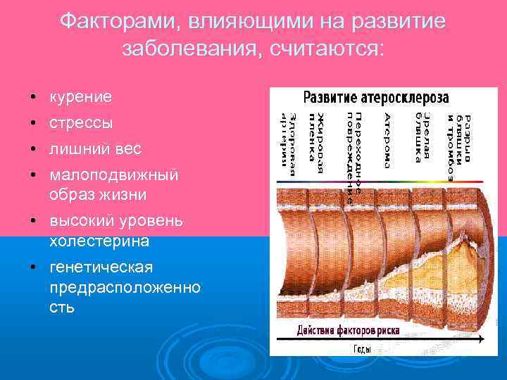 Факторами, влияющими на развитие заболевания, считаются: • курение • стрессы • лишний вес •