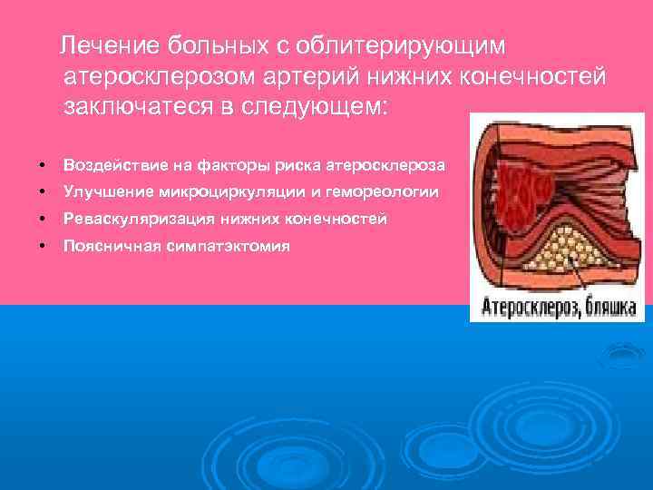 Атеросклероз нижних конечностей проблемы пациента. Проблемы пациента с атеросклерозом сосудов нижних конечностей. Приоритетная проблема пациента при атеросклерозе нижних конечностей. Поясничная симпатэктомия при атеросклерозе нижних конечностей. Атеросклероз артерий конечностей сестринский уход.