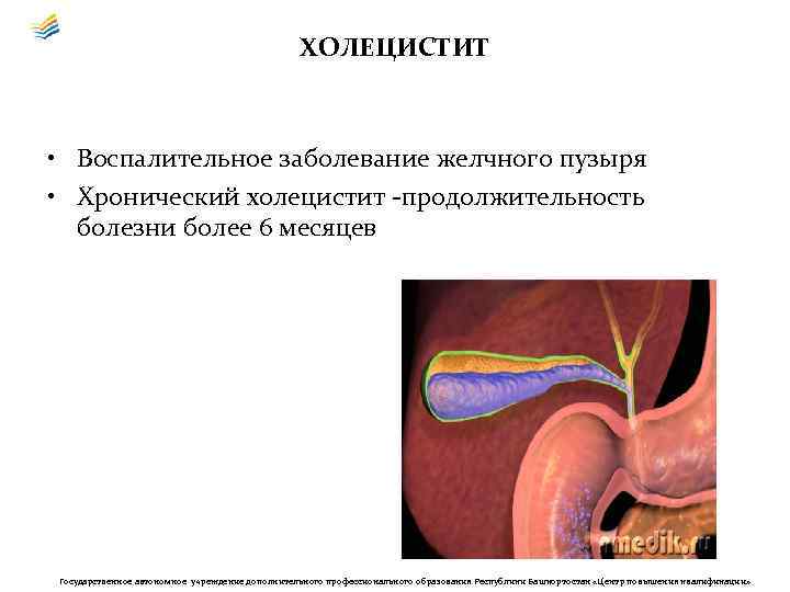 ХОЛЕЦИСТИТ • Воспалительное заболевание желчного пузыря • Хронический холецистит -продолжительность болезни более 6 месяцев