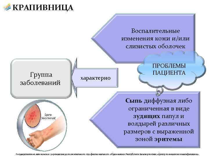 КРАПИВНИЦА Воспалительные изменения кожи и/или слизистых оболочек Группа заболеваний характерно ПРОБЛЕМЫ ПАЦИЕНТА Сыпь диффузная