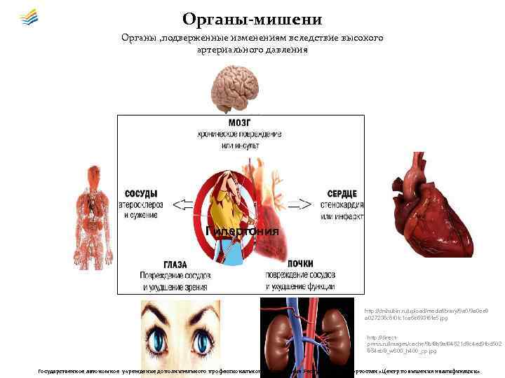 Органы-мишени Органы , подверженные изменениям вследствие высокого артериального давления Гипертония http: //drshubin. ru/upload/medialibrary/9 a