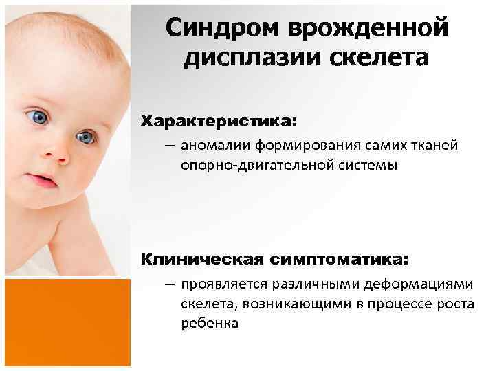 Синдром врожденной дисплазии скелета Характеристика: – аномалии формирования самих тканей опорно-двигательной системы Клиническая симптоматика: