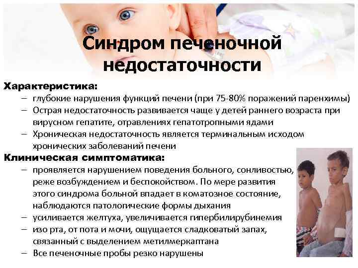 Синдром печеночной недостаточности Характеристика: – глубокие нарушения функций печени (при 75 -80% поражений паренхимы)