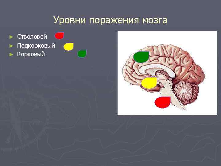 Уровни поражения мозга Стволовой ► Подкорковый ► Корковый ► 