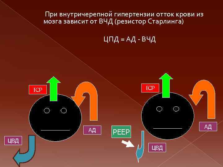 При внутричерепной гипертензии отток крови из мозга зависит от ВЧД (резистор Старлинга) ЦПД =