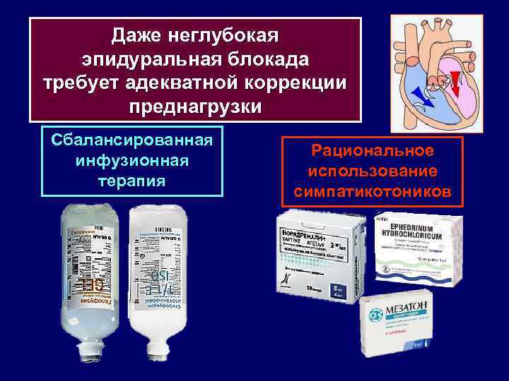 Даже неглубокая эпидуральная блокада требует адекватной коррекции преднагрузки Сбалансированная инфузионная терапия Рациональное использование симпатикотоников