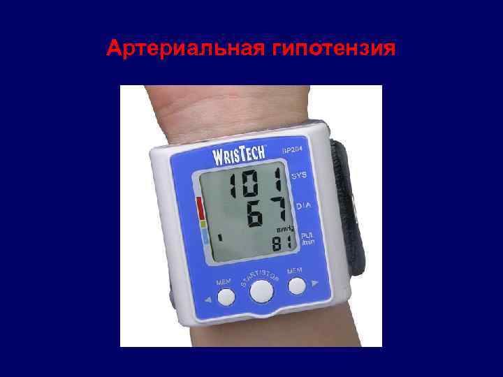 Артериальная гипотензия 
