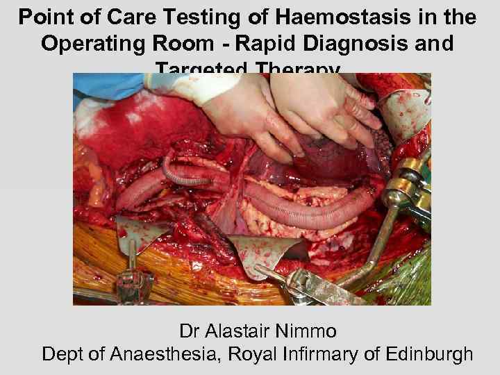 Point of Care Testing of Haemostasis in the Operating Room - Rapid Diagnosis and