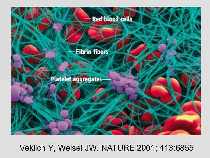 Veklich Y, Weisel JW. NATURE 2001; 413: 6855 