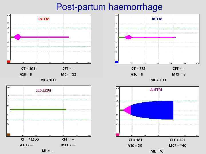 Post-partum haemorrhage Ex. TEM CT = 161 A 10 = 0 In. TEM CFT