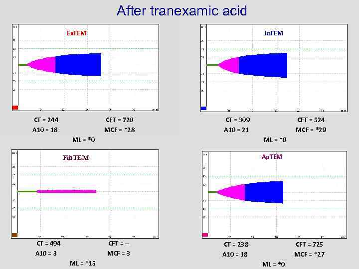 After tranexamic acid Ex. TEM CT = 244 A 10 = 18 In. TEM