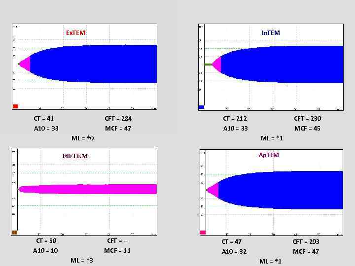 Ex. TEM CT = 41 A 10 = 33 In. TEM CFT = 284