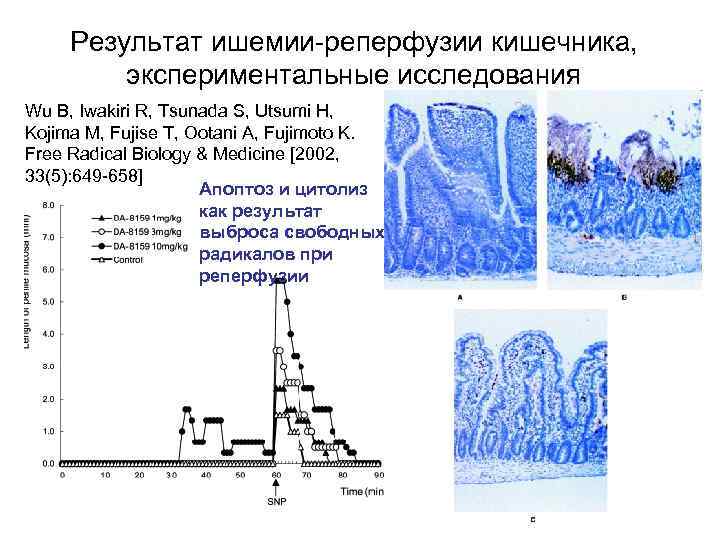 Результат ишемии-реперфузии кишечника, экспериментальные исследования Wu B, Iwakiri R, Tsunada S, Utsumi H, Kojima