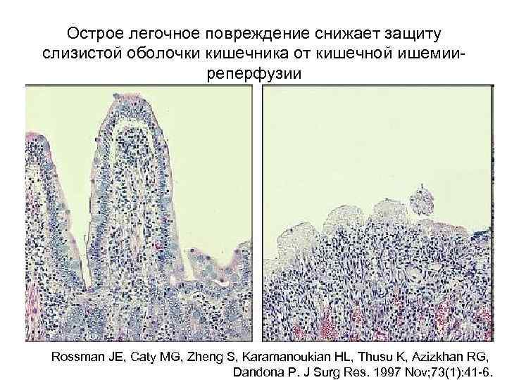 Острое легочное повреждение снижает защиту слизистой оболочки кишечника от кишечной ишемииреперфузии Rossman JE, Caty