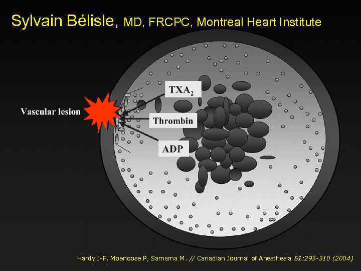 Sylvain Bélisle, MD, FRCPC, Montreal Heart Institute Hardy J-F, Moerloose P, Samama M. //