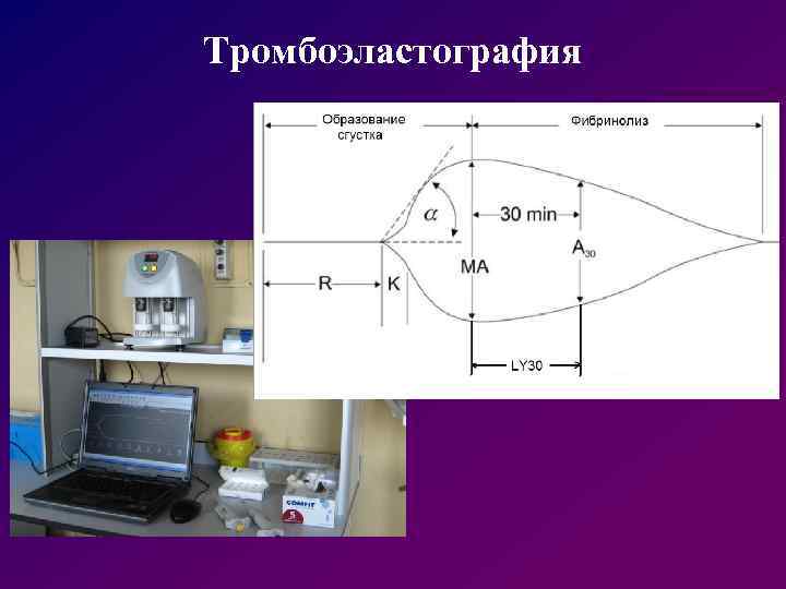 Тромбоэластография 