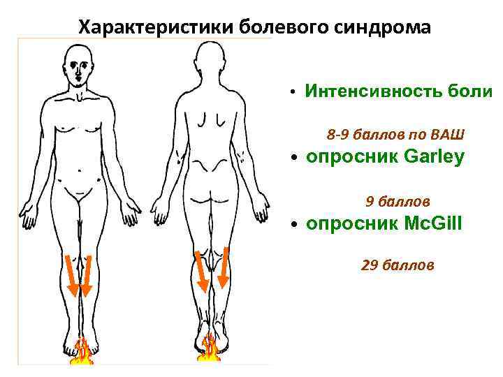 Характеристики болевого синдрома • Интенсивность боли 8 -9 баллов по ВАШ • опросник Garley