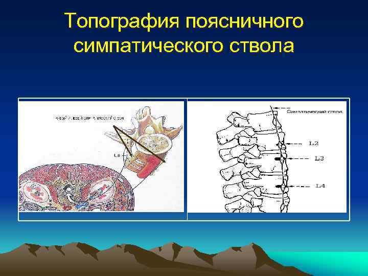 Топография поясничного симпатического ствола 