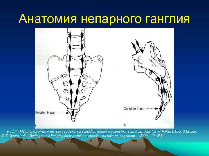 Анатомия непарного ганглия Рис. 1. Местоположение непарного ганглия (ganglion impar) в симпатической цепочке (из