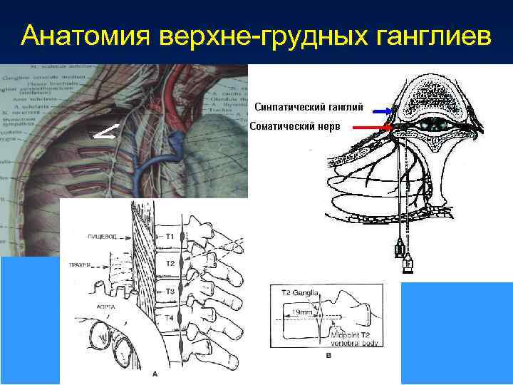 Анатомия верхне-грудных ганглиев 