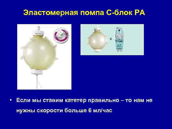 Эластомерная помпа С-блок РА • Если мы ставим катетер правильно – то нам не