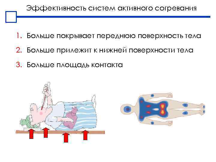 Эффективность систем активного согревания 1. Больше покрывает переднюю поверхность тела 2. Больше прилежит к