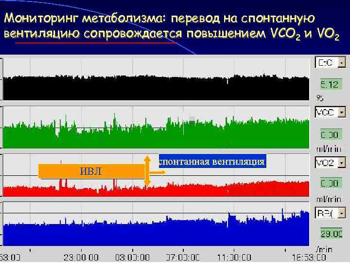 Мониторинг метаболизма: перевод на спонтанную вентиляцию сопровождается повышением VCO 2 и VO 2 ИВЛ