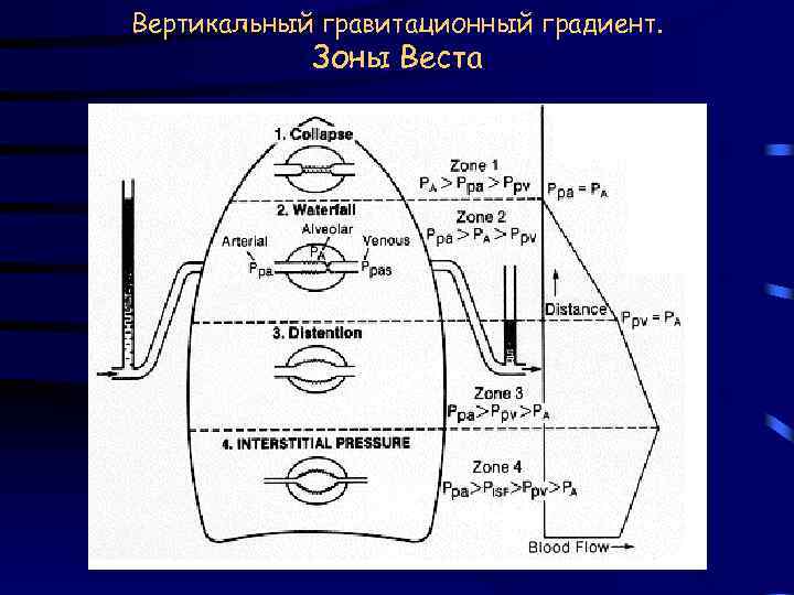 Вертикальный гравитационный градиент. Зоны Веста 