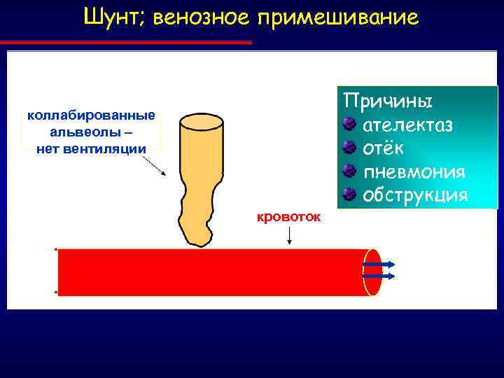 Шунт; венозное примешивание Причины ателектаз отёк пневмония обструкция коллабированные альвеолы – нет вентиляции кровоток