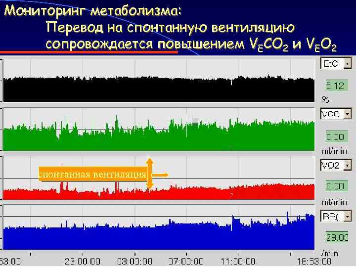 Мониторинг метаболизма: Перевод на спонтанную вентиляцию сопровождается повышением VECO 2 и VEO 2 спонтанная