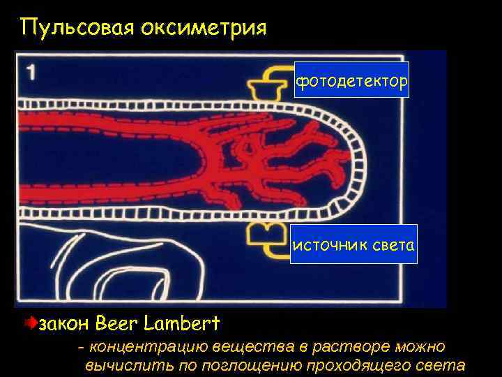 Пульсовая оксиметрия фотодетектор источник света закон Beer Lambert - концентрацию вещества в растворе можно