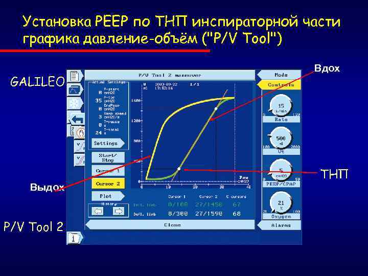 Диаграмма давление объем. Инспираторное давление. Диаграмма давление объём для азота. Прибор записи диаграмм 