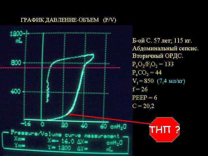 ГРАФИК ДАВЛЕНИЕ-ОБЪЕМ (P/V) Б-ой С. 57 лет; 115 кг. Абдоминальный сепсис. Вторичный ОРДС. Pa.