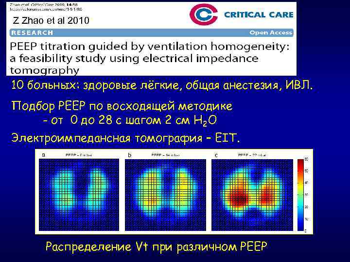 Z Zhao et al 2010* 10 больных: здоровые лёгкие, общая анестезия, ИВЛ. Подбор РЕЕР
