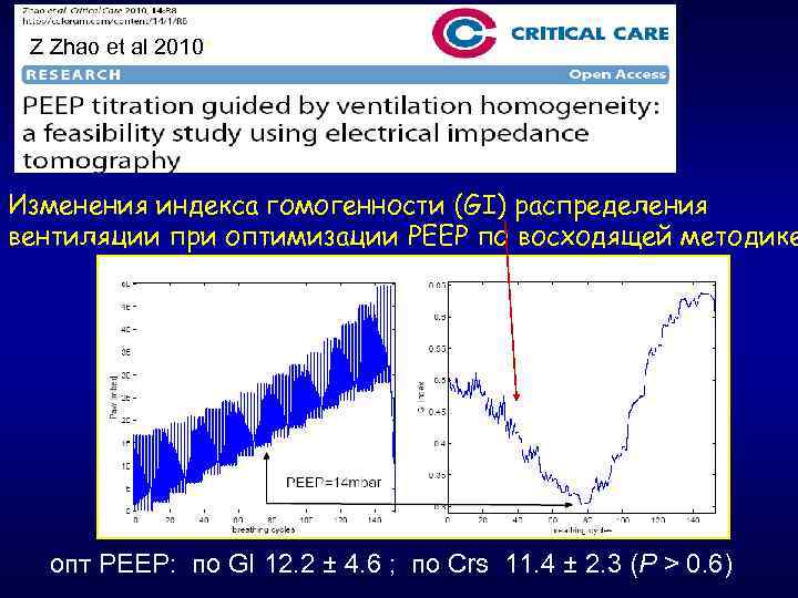 Z Zhao et al 2010* Изменения индекса гомогенности (GI) распределения вентиляции при оптимизации РЕЕР
