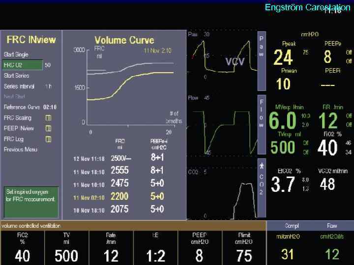 Engström Carestation 