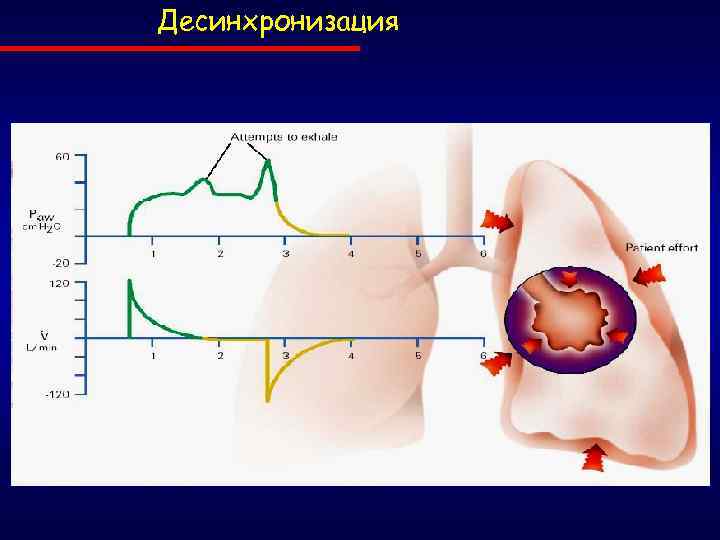 Десинхронизация 