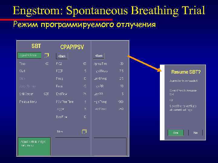 Engstrom: Spontaneous Breathing Trial Режим программируемого отлучения 