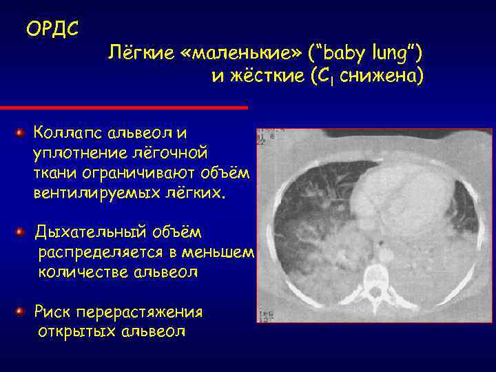 Уплотнение легкого при ордс связано