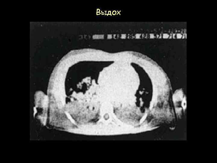 Выдох 
