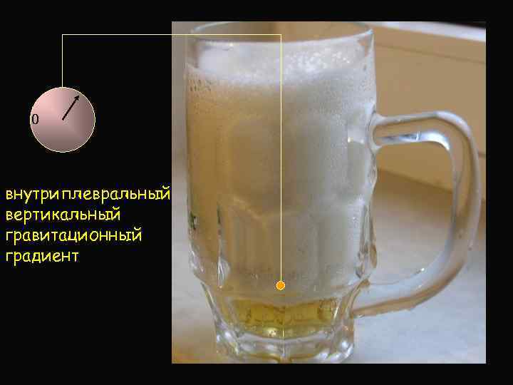 0 внутриплевральный вертикальный гравитационный градиент 