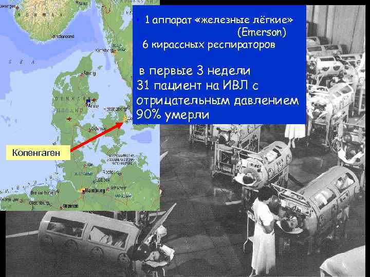  • 1 аппарат «железные лёгкие» (Emerson) 6 кирассных респираторов в первые 3 недели